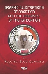 Graphic Illustrations Of Abortion And The Diseases Of Menstruation - Gece Kitaplığı