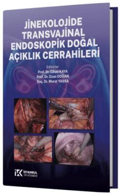 Jinekolojide Transvajinal Endoskopik Doğal Açıklık Cerrahileri - 1