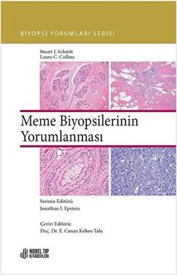 Meme Biyopsilerinin Yorumlanması - 1