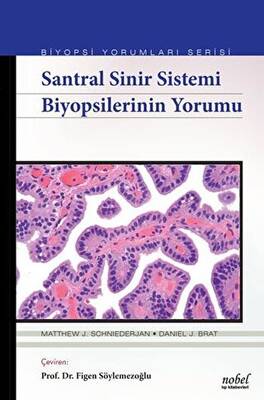 Santral Sinir Sistemi Biyopsilerinin Yorumu - 1