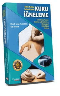 Tetik Nokta Tedavisinde Kuru İğneleme - 1