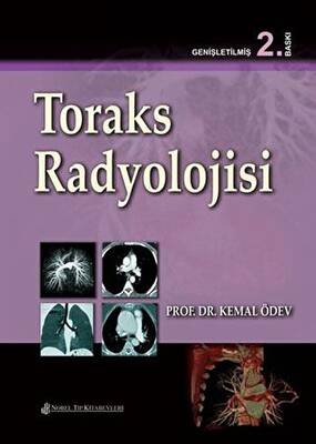Toraks Radyolojisi - 1
