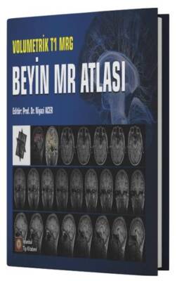 Volumetrik T1 MRG Beyin MR Atlası - 1